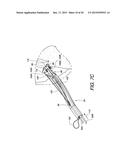 MINIMALLY INVASIVE SURGICAL SUTURING DEVICE FOR PAPILLARY MUSCLES AND     METHODS THEREOF diagram and image