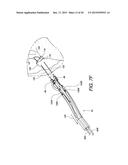 MINIMALLY INVASIVE SURGICAL SUTURING DEVICE FOR PAPILLARY MUSCLES AND     METHODS THEREOF diagram and image