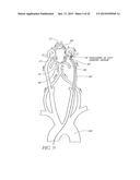 SYSTEMS AND METHODS FOR REMOVING OBSTRUCTIVE MATTER FROM BODY LUMENS AND     TREATING VASCULAR DEFECTS diagram and image