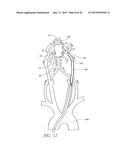 SYSTEMS AND METHODS FOR REMOVING OBSTRUCTIVE MATTER FROM BODY LUMENS AND     TREATING VASCULAR DEFECTS diagram and image