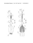 SYSTEMS AND METHODS FOR REMOVING OBSTRUCTIVE MATTER FROM BODY LUMENS AND     TREATING VASCULAR DEFECTS diagram and image