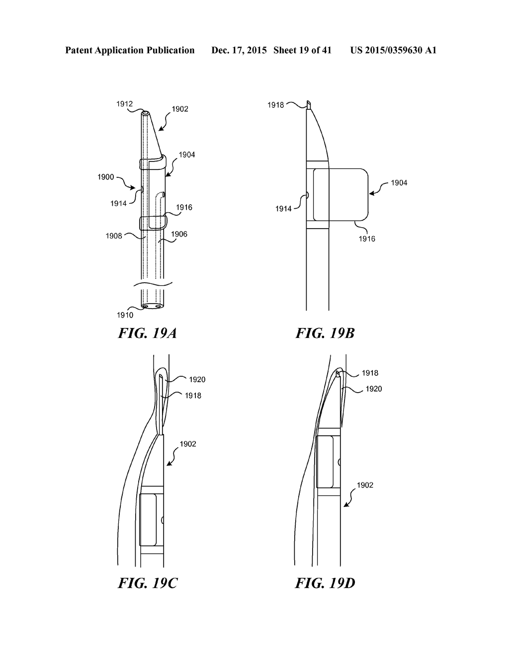 SYSTEMS AND METHODS FOR ENDOLUMINAL VALVE CREATION - diagram, schematic, and image 20