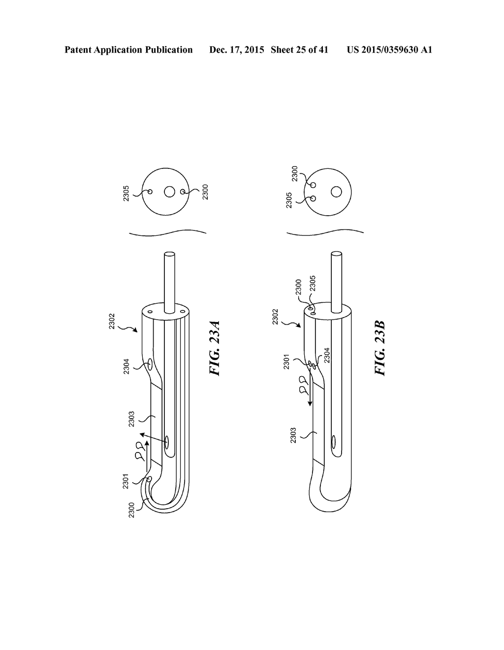 SYSTEMS AND METHODS FOR ENDOLUMINAL VALVE CREATION - diagram, schematic, and image 26