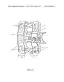 INTERSPINOUS IMPLANTS diagram and image