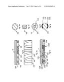 HOLDING MEANS FOR COUPLING AT LEAST ONE GUIDING/SUPPORTING STRUCTURE  TO A     LIVING BEING diagram and image