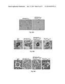 METHODS OF TREATING, PREVENTING AND DIAGNOSING LEUKEMIA AND OTHER BLOOD     DISEASES AND DISORDERS diagram and image