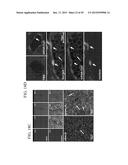 LIPIDS, LIPID COMPLEXES AND USE THEREOF diagram and image