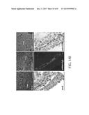 LIPIDS, LIPID COMPLEXES AND USE THEREOF diagram and image