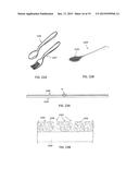 COATINGS FOR THE CONTROLLABLE RELEASE OF ANTIMICROBIAL METAL IONS diagram and image