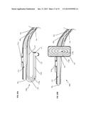 SELF-CLEANING SURGICAL SUCTION DEVICE AND METHOD OF USE diagram and image