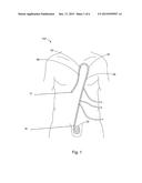 AXIALLY SPLIT FOAM PERITONEAL DIALYSIS CATHETER DESIGN WITH FUNCTIONAL     COATINGS diagram and image