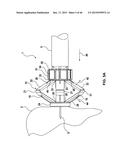 FOLDING PANEL NEEDLE GUARD diagram and image