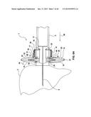 FOLDING PANEL NEEDLE GUARD diagram and image