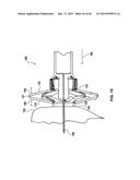 FOLDING PANEL NEEDLE GUARD diagram and image