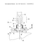 FOLDING PANEL NEEDLE GUARD diagram and image