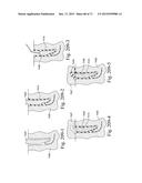 CUSHIONING STRUCTURE diagram and image