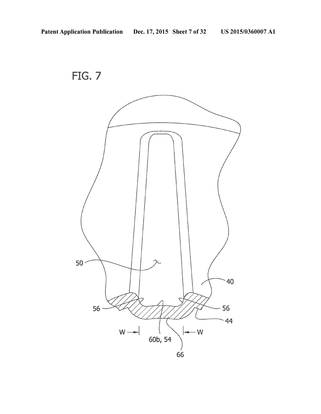 MEDICAL BALLOON INCLUDING PLEATS - diagram, schematic, and image 08