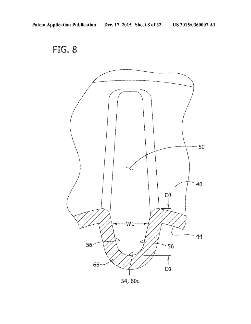 MEDICAL BALLOON INCLUDING PLEATS - diagram, schematic, and image 09