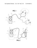 Transcutaneous Electrostimulator and Methods for Electric Stimulation diagram and image