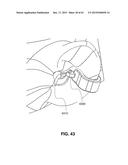 Transcutaneous Electrostimulator and Methods for Electric Stimulation diagram and image