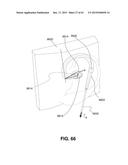 Transcutaneous Electrostimulator and Methods for Electric Stimulation diagram and image