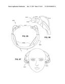 Transcutaneous Electrostimulator and Methods for Electric Stimulation diagram and image