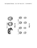 SYSTEMS AND METHODS FOR DETERMINING EFFECTIVE STIMULATION PARAMETERS diagram and image