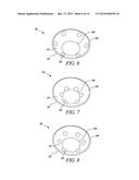 DEVICE FOR SEALING ORIFICES ON NOZZLE OF FUEL INJECTOR FOR AUTOFRETTAGE     PROCESS diagram and image