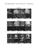 In Vitro Production of Medial Ganglionic Eminence Precursor Cells diagram and image