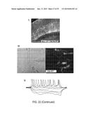 In Vitro Production of Medial Ganglionic Eminence Precursor Cells diagram and image