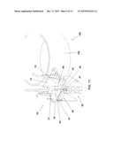 Assembly for mooring a pile with a mooring line and method implemented     with said assembly diagram and image