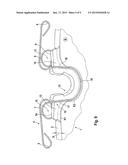 FRICTION LINING WITH A STEEL WIRE BOW SPRING diagram and image