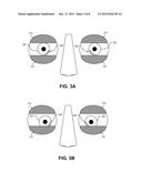 CAPACITIVE GAZE TRACKING FOR AUTO-ACCOMMODATION IN A CONTACT LENS diagram and image