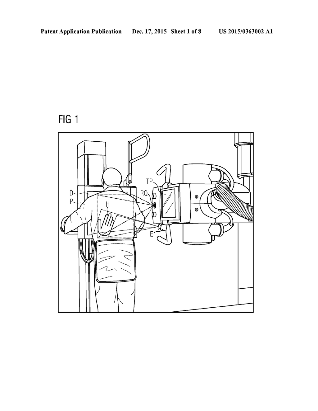 DEVICE AND METHOD FOR THE GESTURE-CONTROLLED SETTING OF SETTING VARIABLES     ON AN X-RAY SOURCE - diagram, schematic, and image 02