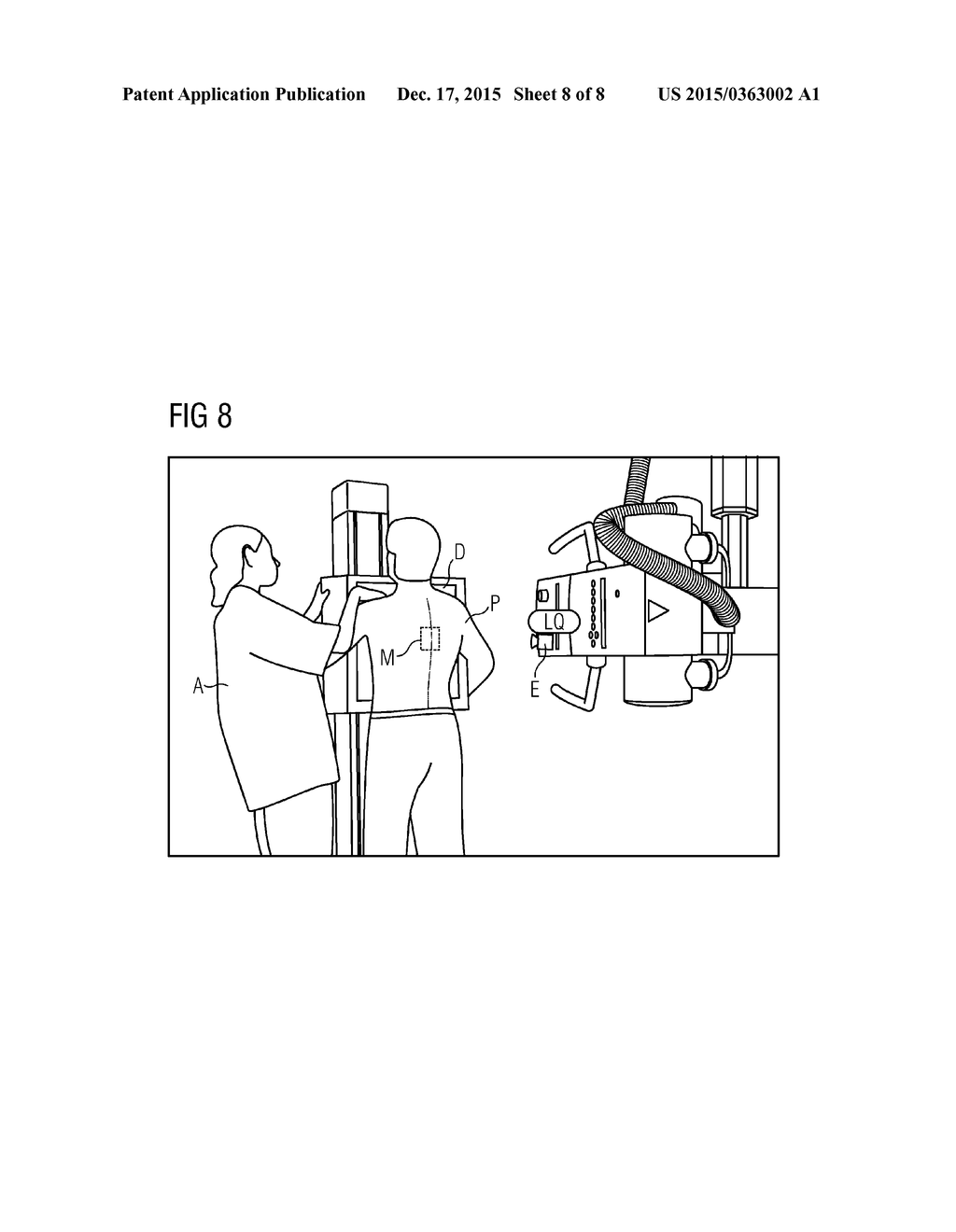 DEVICE AND METHOD FOR THE GESTURE-CONTROLLED SETTING OF SETTING VARIABLES     ON AN X-RAY SOURCE - diagram, schematic, and image 09