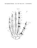 METHOD FOR ORIENTING A HAND ON A TOUCHPAD OF A COMPUTERIZED SYSTEM diagram and image