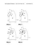 EMS GARMENT diagram and image