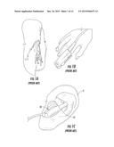 Physiological Monitoring Devices Having Sensing Elements Decoupled from     Body Motion diagram and image