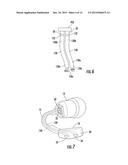 Physiological Monitoring Devices Having Sensing Elements Decoupled from     Body Motion diagram and image