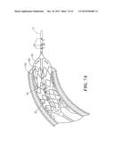 DEVICES AND METHODS FOR SIZING VALVE APERTURES AND LUMINAL ORGANS diagram and image