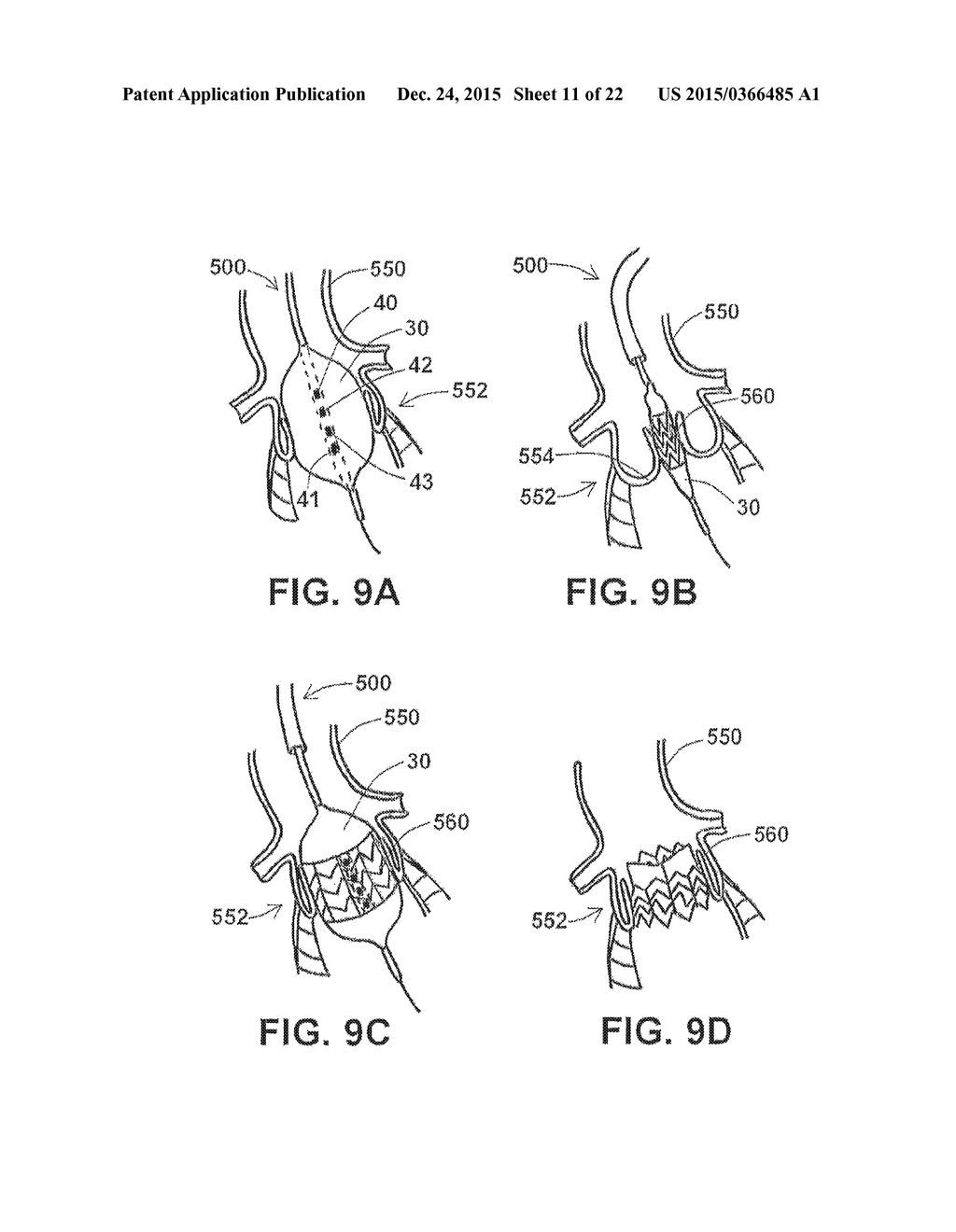 DEVICES AND METHODS FOR SIZING VALVE APERTURES AND LUMINAL ORGANS - diagram, schematic, and image 12
