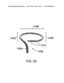 DEVICES AND METHODS FOR SIZING VALVE APERTURES AND LUMINAL ORGANS diagram and image