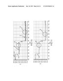 Dynamic adaptive respiration compensation with automatic gain control diagram and image