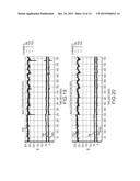 Dynamic adaptive respiration compensation with automatic gain control diagram and image