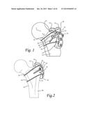 Method of Dynamically Compressing a Fracture diagram and image