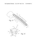 Method of Dynamically Compressing a Fracture diagram and image