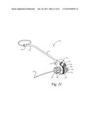 Method of Dynamically Compressing a Fracture diagram and image