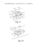 Method of Dynamically Compressing a Fracture diagram and image