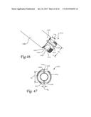 Method of Dynamically Compressing a Fracture diagram and image