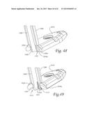 Method of Dynamically Compressing a Fracture diagram and image